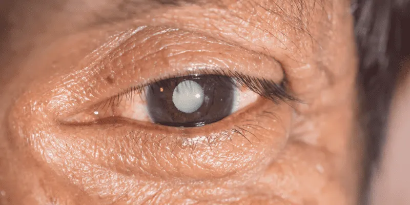 cataratas_especialidades