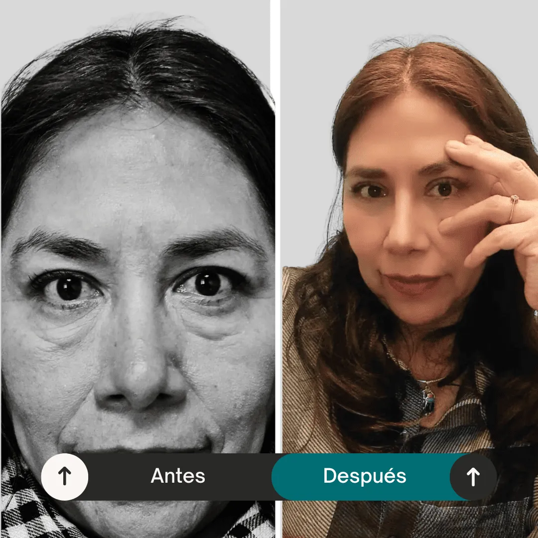 imgi_24_antes-despues4