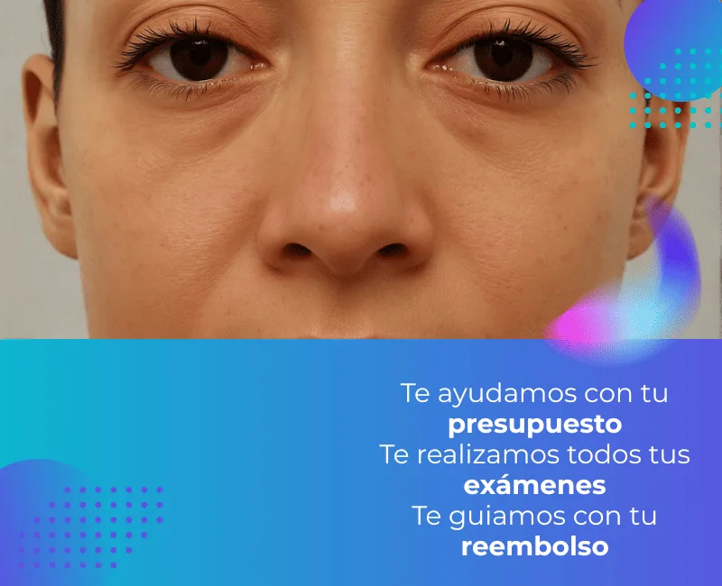 Antes 2 (2)-mobile Antes 2 (2)-mobile