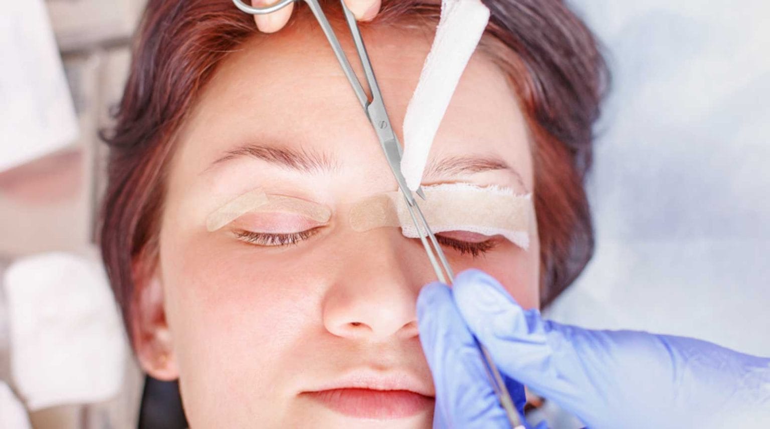 Blefaroplastia-procedimiento