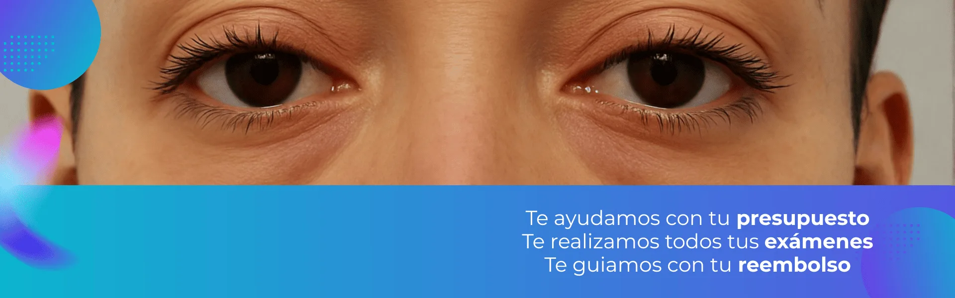 Después 2 Después 2