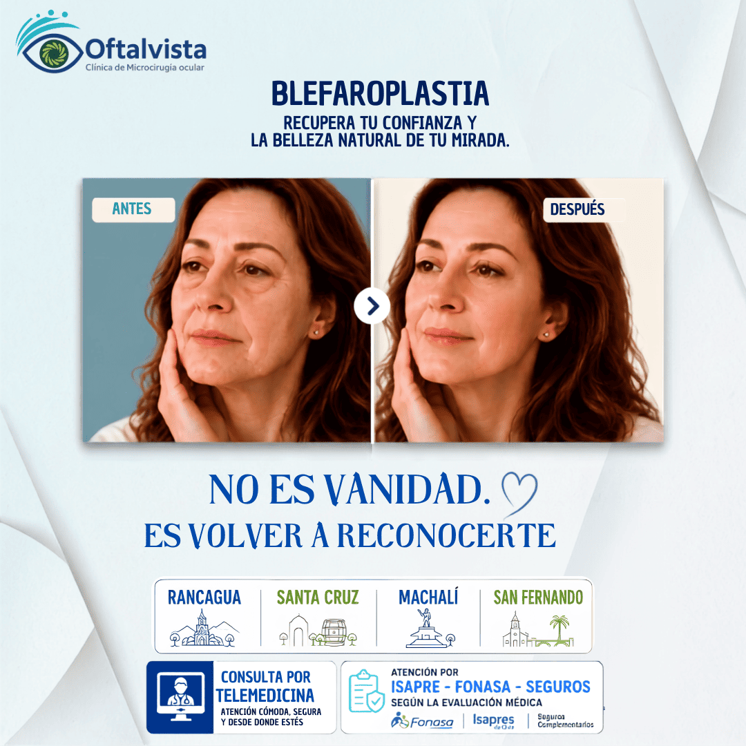 prom-agosto-mobile-Beflaroplastia Rancagua y Santiago